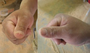 “Just a small nick on his thumb.”