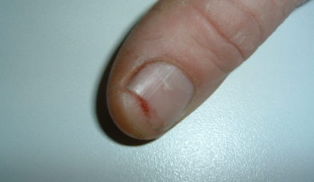 “The blade stopped immediately.”