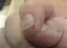 “It can happen to anyone.”